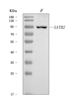SATB2 Rabbit Polyclonal Antibody