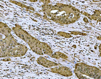 MAT2A Rabbit Polyclonal Antibody