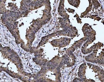MAT2A Rabbit Polyclonal Antibody