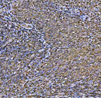 MAT2A Rabbit Polyclonal Antibody