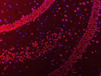 hnRNP U/p120/HNRNPU Antibody