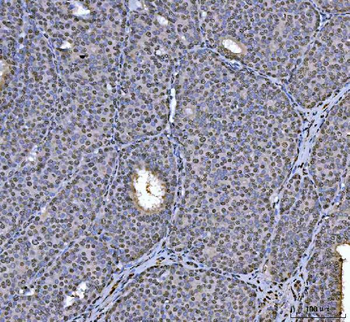 hnRNP U/p120/HNRNPU Antibody