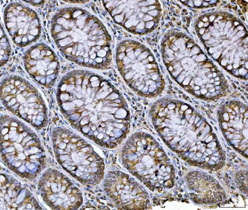 hnRNP U/p120/HNRNPU Antibody