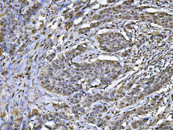 hnRNP U/p120/HNRNPU Antibody