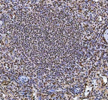 hnRNP L/HNRNPL Antibody