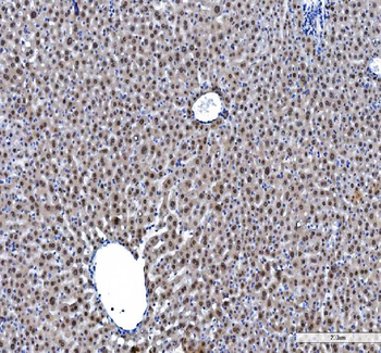 hnRNP L/HNRNPL Antibody