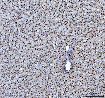 hnRNP L/HNRNPL Antibody