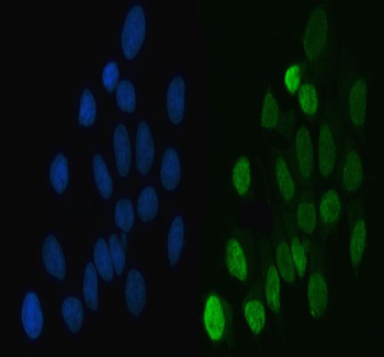 hnRNP L/HNRNPL Antibody