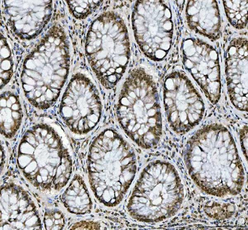 hnRNP L/HNRNPL Antibody