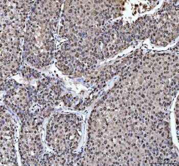 hnRNP L/HNRNPL Antibody