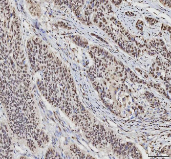 hnRNP L/HNRNPL Antibody