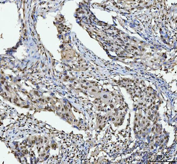 hnRNP L/HNRNPL Antibody