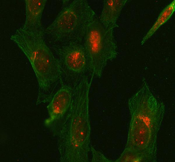 GSK3 beta/GSK3B Rabbit Polyclonal Antibody