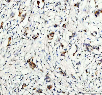 GSK3 beta/GSK3B Rabbit Polyclonal Antibody
