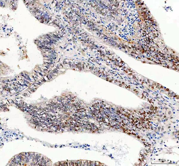 GSK3 beta/GSK3B Rabbit Polyclonal Antibody