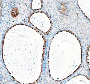 GSK3 beta/GSK3B Rabbit Polyclonal Antibody