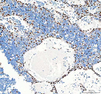 GSK3 beta/GSK3B Rabbit Polyclonal Antibody