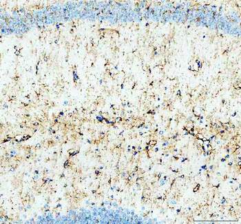 GSK3 beta/GSK3B Rabbit Polyclonal Antibody