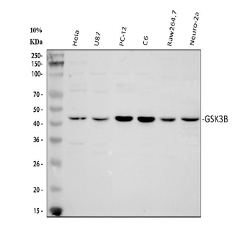 GSK3 beta/GSK3B Rabbit Polyclonal Antibody