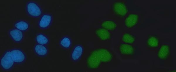 Exonuclease 1/EXO1 Rabbit Polyclonal Antibody