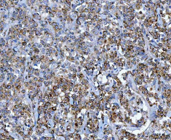 CAD Rabbit Polyclonal Antibody