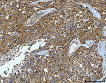 CAD Rabbit Polyclonal Antibody