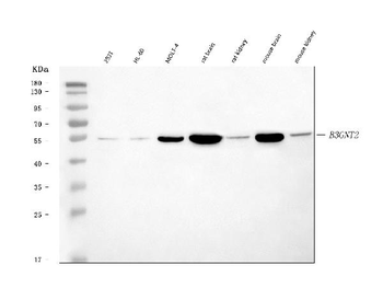 B3GNT2 Antibody