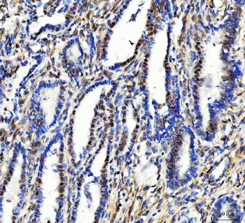 Aurora A/AURKA Antibody
