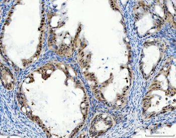 Aurora A/AURKA Antibody