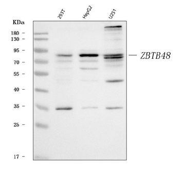 ZBTB48 Rabbit Polyclonal Antibody