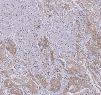 WDR44 Rabbit Polyclonal Antibody
