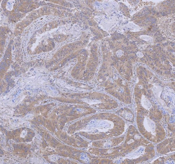 WDR44 Rabbit Polyclonal Antibody