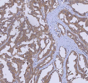 WDR44 Rabbit Polyclonal Antibody
