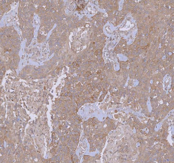 WDR44 Rabbit Polyclonal Antibody