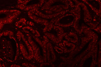 XRCC4 Rabbit Polyclonal Antibody