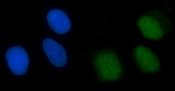 XRCC4 Rabbit Polyclonal Antibody