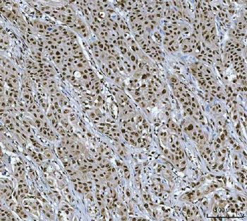 XRCC4 Rabbit Polyclonal Antibody