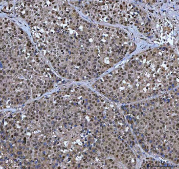XRCC4 Rabbit Polyclonal Antibody