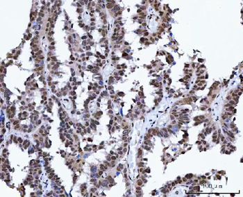 XRCC4 Rabbit Polyclonal Antibody