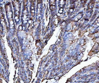 VAPA Rabbit Polyclonal Antibody