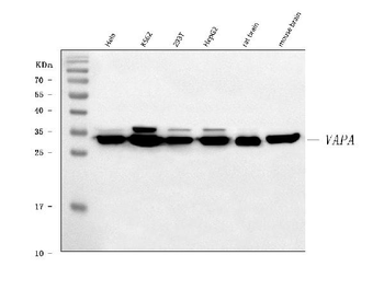 VAPA Rabbit Polyclonal Antibody