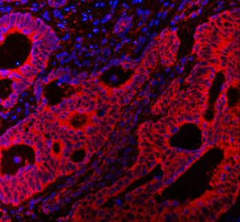 VAPA Rabbit Polyclonal Antibody