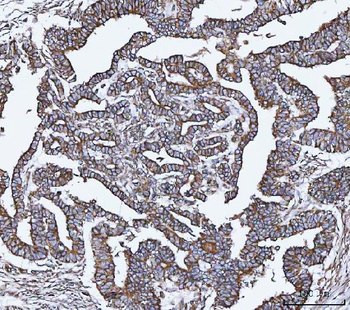 VAPA Rabbit Polyclonal Antibody