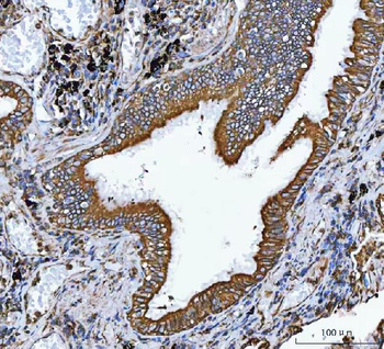 VAPA Rabbit Polyclonal Antibody