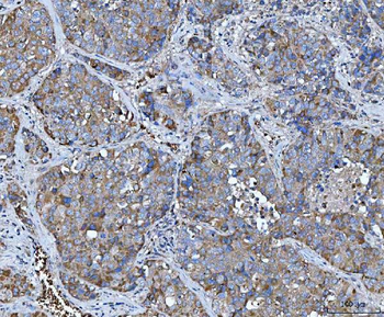 TRMT61B Rabbit Polyclonal Antibody