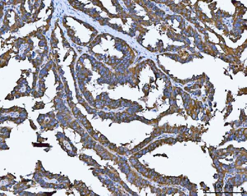 TRMT61B Rabbit Polyclonal Antibody