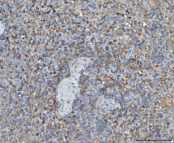TRMT61B Rabbit Polyclonal Antibody