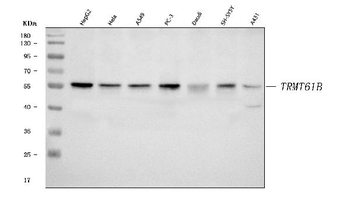 TRMT61B Rabbit Polyclonal Antibody