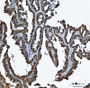 TRMT10C Rabbit Polyclonal Antibody