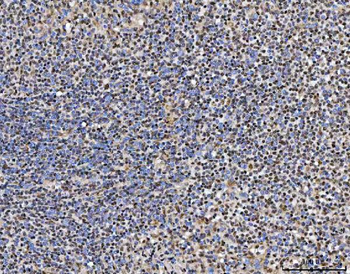 TRMT10C Rabbit Polyclonal Antibody